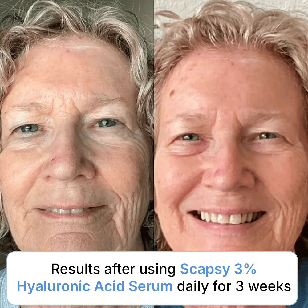 Ultra Hydrating 3% Hyaluronic Acid Serum