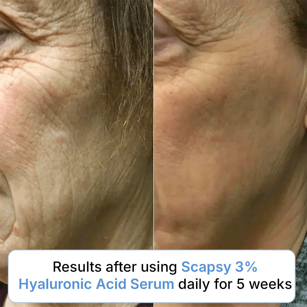 Ultra Hydrating 3% Hyaluronic Acid Serum