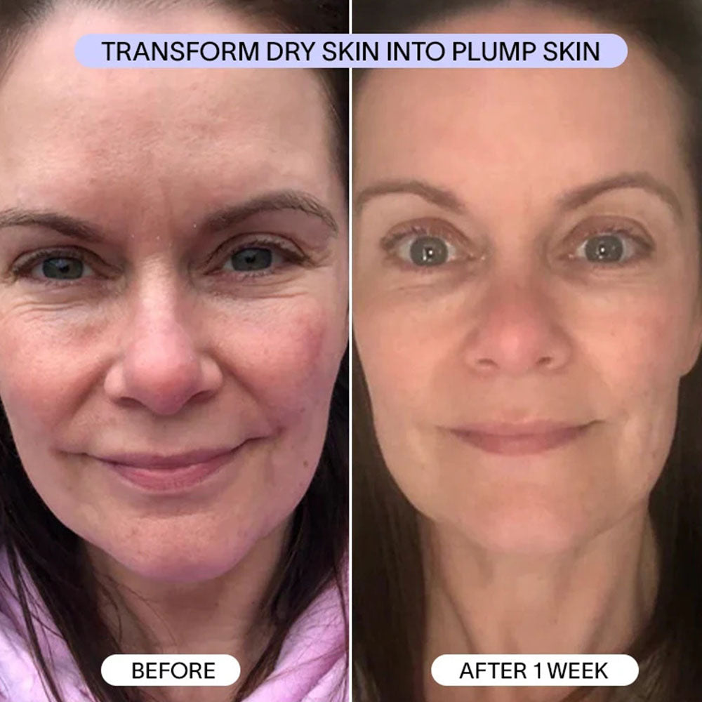 PDRN Collagen Mask