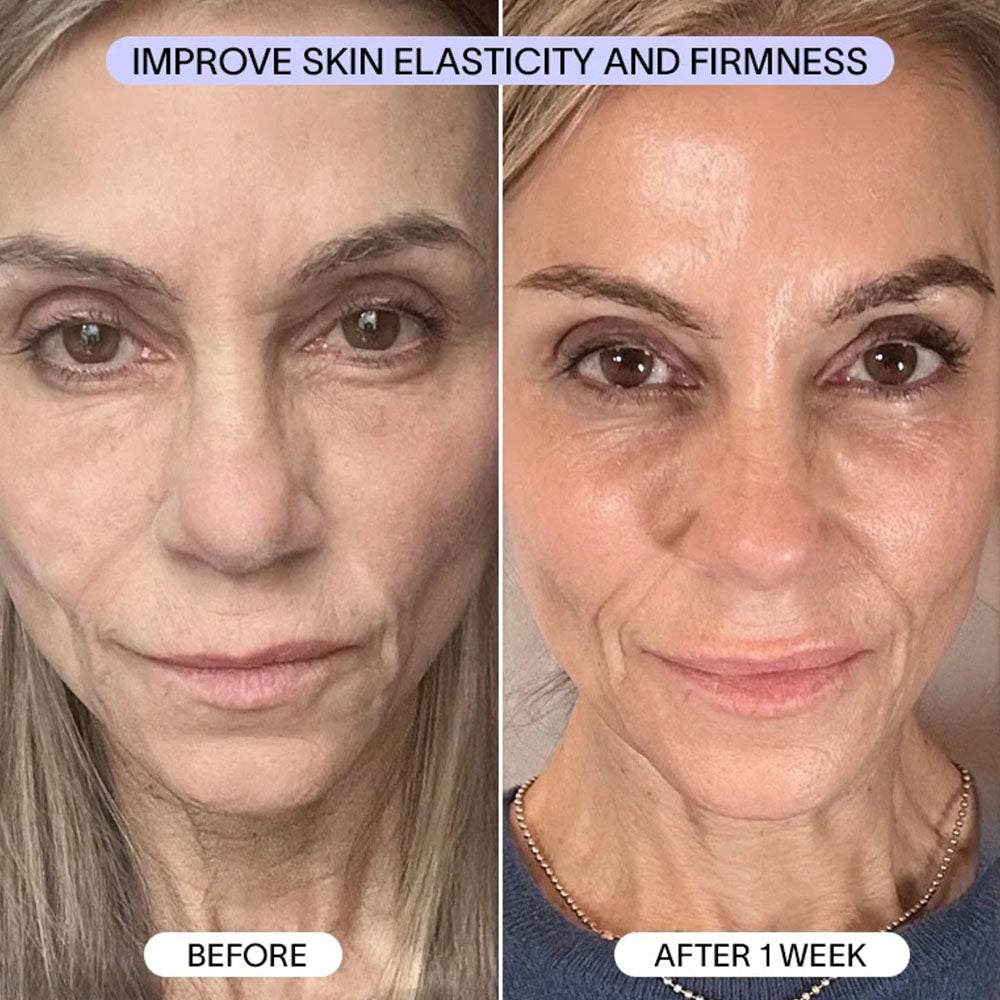 PDRN Collagen Mask